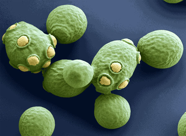  Saccharomyces cerevisiae:  ࠗ     .      6704,   2460   .    952  ,  216  .    www.microbiologyonline.org.uk