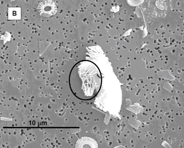 Частицы карбоната в поверхностном слое донных отложений. Снимок (электронная сканирующая микроскопия) осадка в седиментационной ловушке, установленной в Бенгальском заливе. Автор снимка Dr. Heather Stoll. Комочек кристаллов, скорее всего образовавшийся в кишечнике рыбы, выделен черным овалом. Правильные концентрические образования внизу и вверху снимка — остатки кокколитофорид. Большая часть неидентифицируемых частиц — остатки скелетов кокколитофорид и фораминифер. Длина масштабной линейки — 10 мкм. Рис. из дополнительных материалов к обсуждаемой статье в Science