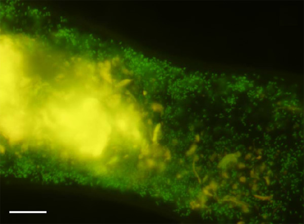 Pseudotrichonympha grassi        FISH (fluorescence in situ hybridization).    蠗   , 젗   .    10.       Science