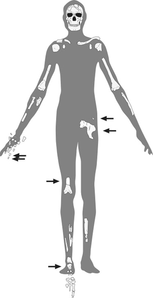 Найденные части скелета Омо I. Стрелками показаны кости, добытые во время раскопок 1999–2003 гг. Рис. из статьи Pearson et al. A description of the Omo I postcranial skeleton, including newly discovered fossils // Journal of Human Evolution. 2008. V. 55. P. 421–437