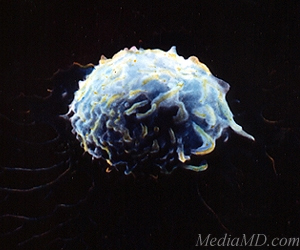 Лимфоциты — белые кровяные клетки, играющие ключевую роль в формировании приобретенного иммунитета (фото с сайта www.merck.com; © Robert Becker/Custom Medical Stock Photo)
