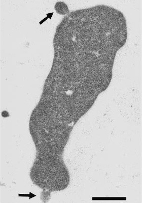 Ферроплазма в процессе почкования (почки показаны стрелками). Масштаб: 500 нанометров. Фото из статьи с первоописанием микроба (O.V.Golyshina et al., 2000)