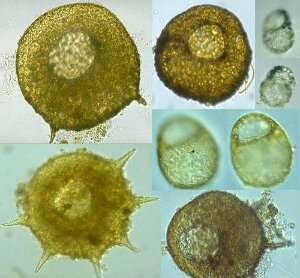     Centropyxis (   protist.i.hosei.ac.jp)