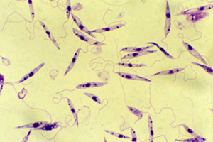 Примитивные одноклеточные паразиты лейшмании, возможно, вскоре станут спасителями многих людей, страдающих тяжелыми наследственными заболеваниями (фото с сайта www.uni-tuebingen.de)