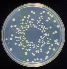       ,  Bifidobacterium longum,     .         (   www.nyusankin.or.jp)