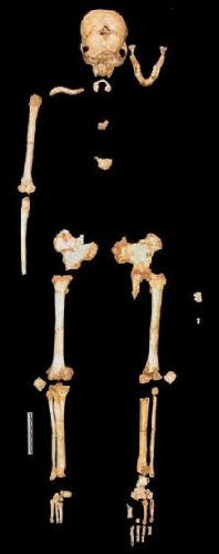   Homo floresiensis   ,     H.erectus (Susan Larson, Stony Brook University;    www.sciencemag.org)