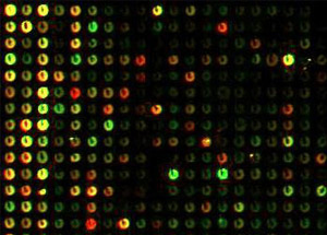 Так выглядит микрочип — стандартное приспособление для измерения уровня активности генов. Яркость свечения каждой из ячеек соответствует уровню активности одного конкретного гена (фото с сайта som.ucdavis.edu)