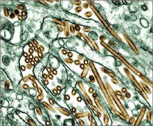 Мутирующий штамм вируса гриппа H5N1 в культуре клеток (фото CDC Public Health Library с сайта yaleglobal.yale.edu)