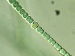 Круглая гетероциста среди цилиндрических фотосинтезирующих клеток в нитевидной колонии цианобактерий (фото с сайта botit.botany.wisc.edu)