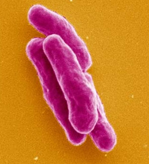 Туберкулез продолжает уносить до трех миллионов человеческих жизней ежегодно. На снимке: Mycobacterium tuberculosis, возбудитель заболевания (изображение с сайта www.microscopyconsulting.com)