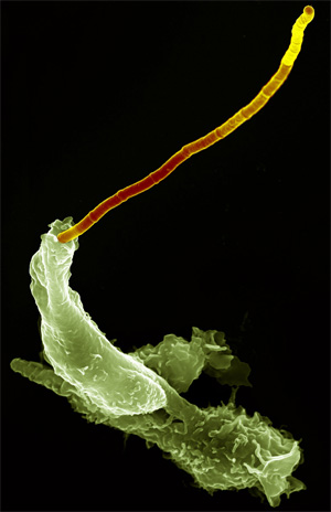 Нейтрофил поглощает бациллу сибирской язвы (фото с сайта www.mpg.de)