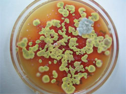 Грибок Penicillium marneffei (фото с сайта www.imperial.ac.uk)