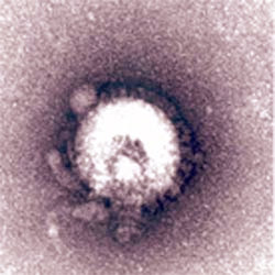 Теперь кроме азиатского вируса птичьего гриппа H5N1 (на фото) можно заразиться еще и европейским (изображение с сайта vnexpress.net)