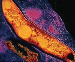  ,           ,   NRAMP1.   Mycobacterium tuberculosis (   biology.kenyon.edu)