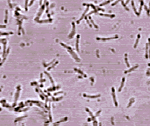 Бактерии из рода Desulfitobacterium — D. hafniense (фото с сайта genome.jgi-psf.org)